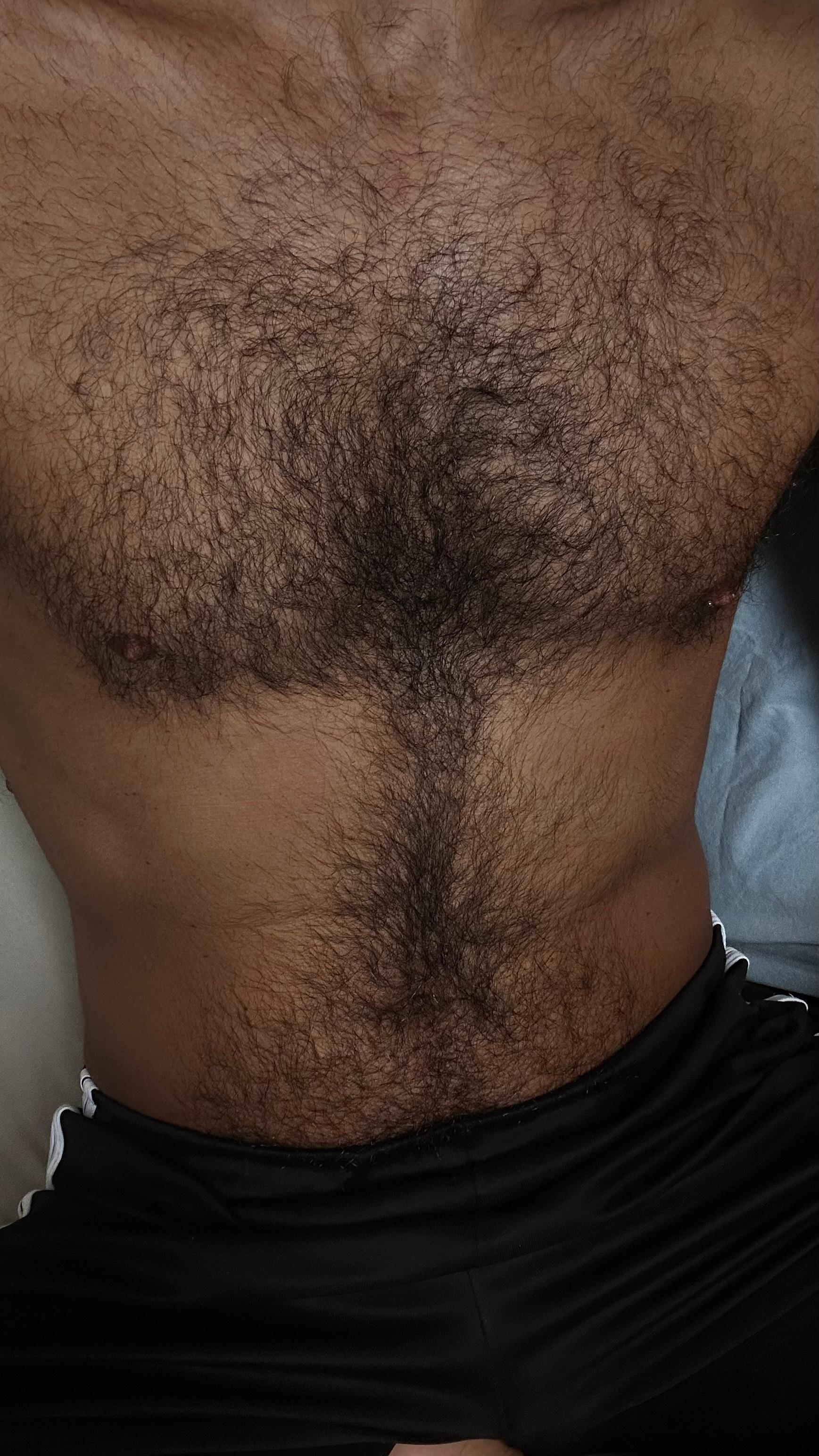 Peludao25 from Brazil